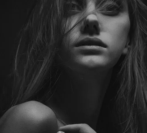 Radiofrecuencia Microagujas